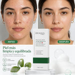 Limpiador Facial