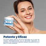 ROYCEDERM ADVANCED SEBORRHEIC DERMATITIS
